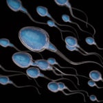 Spermiogram